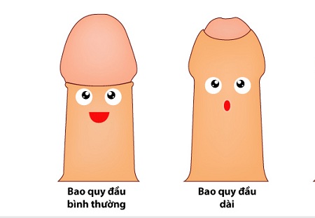 Viêm quy đầu - Hình ảnh minh họa